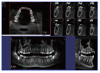 口腔cbct