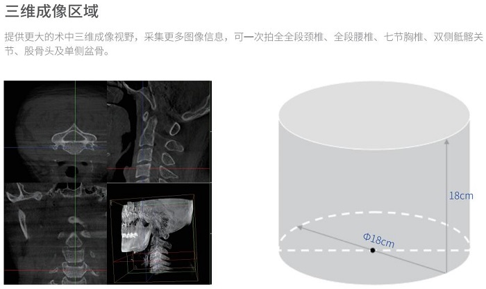 移動三維C形臂術中成像